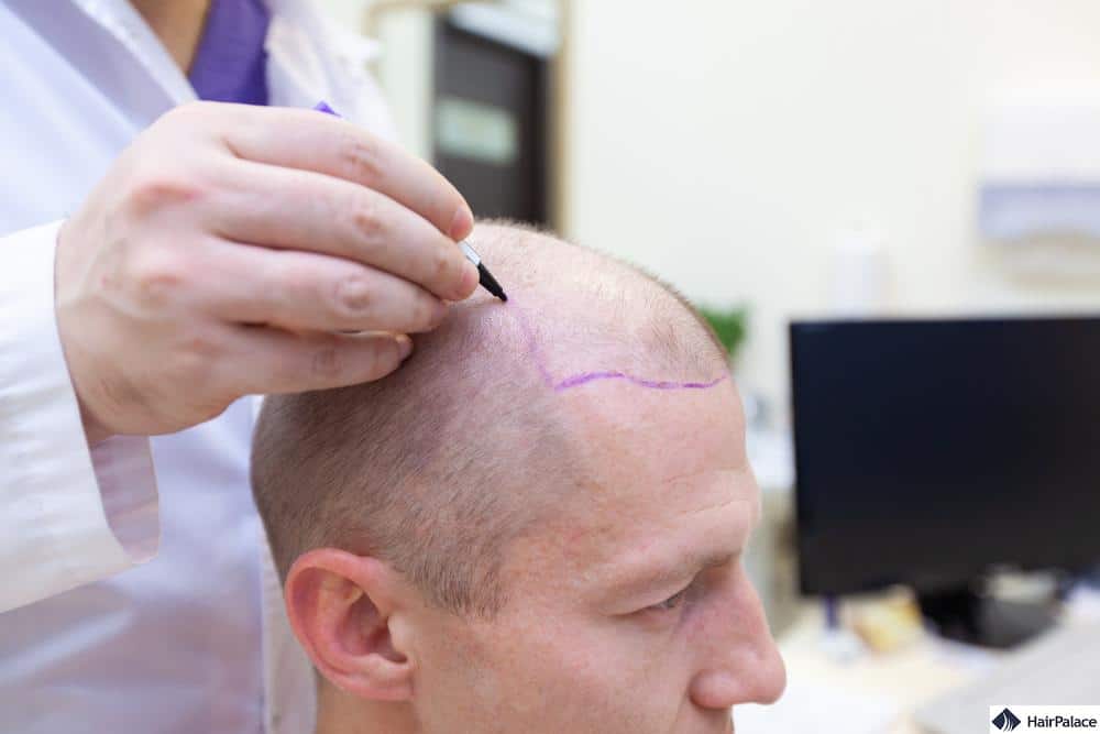 Come può trattare la Sua perdita di capelli?