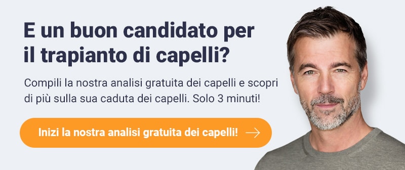 Sei un candidato idoneo per un trapianto di capelli? Compila la nostra analisi del capello gratuita e scopri di più sulla tua perdita dei capelli. Solo 3 minuti! Inizia la nostra analisi del capello gratuita!