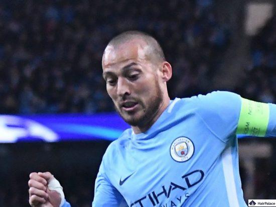 David Silva aveva la caduta dei capelli all'attaccatura dei capelli