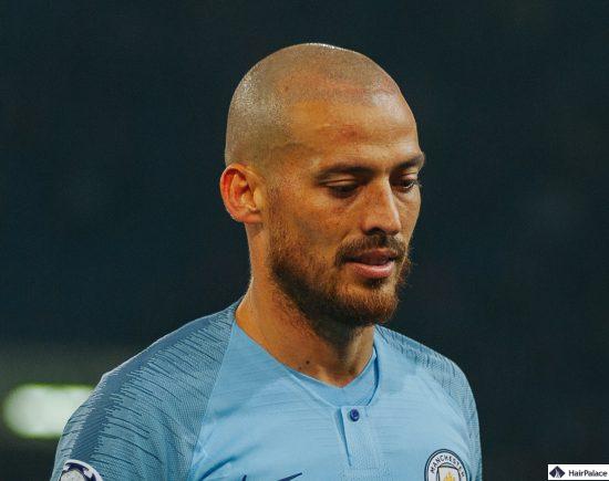 David Silva poco dopo il trapianto di capelli con la sua nuova attaccatura dei capelli visibile