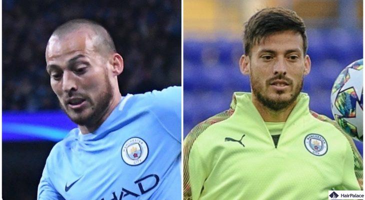 Trapianto di capelli David Silva prima e dopo