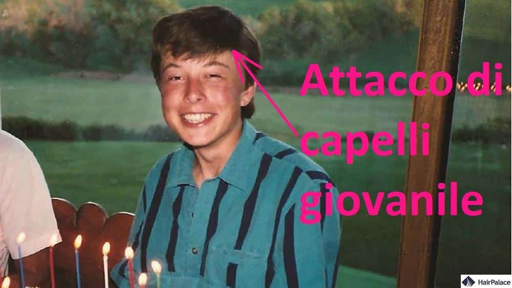 elon musk non ha mostrato segni di perdita di capelli da adolescente