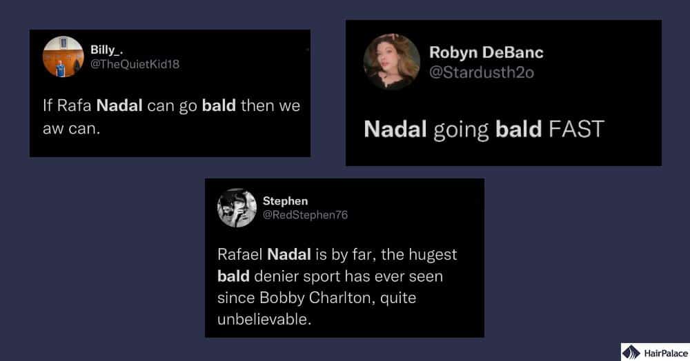 Le reazioni dei fan alla recente caduta dei capelli di Nadal