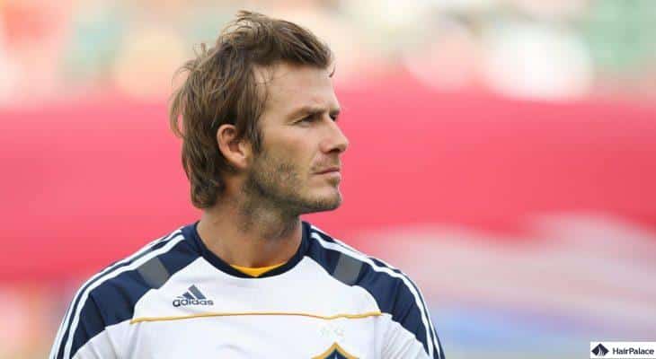 David Beckham trapianto di capelli risultati