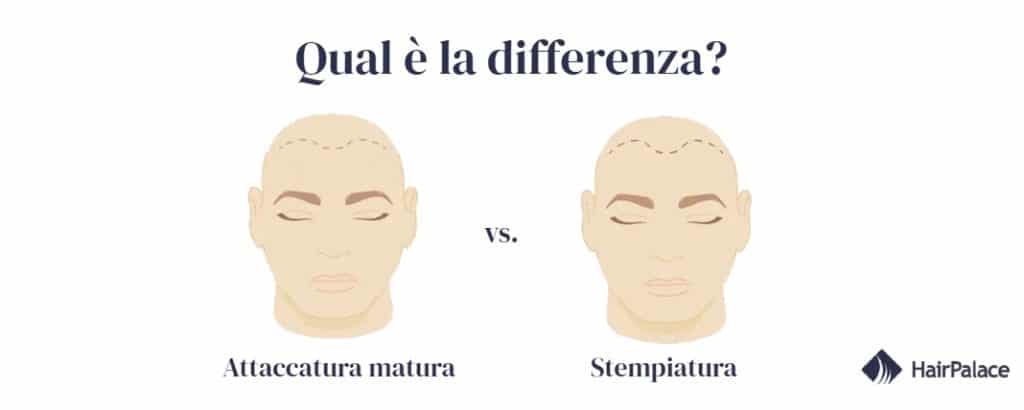 differenza stempiatura e attaccatura matura