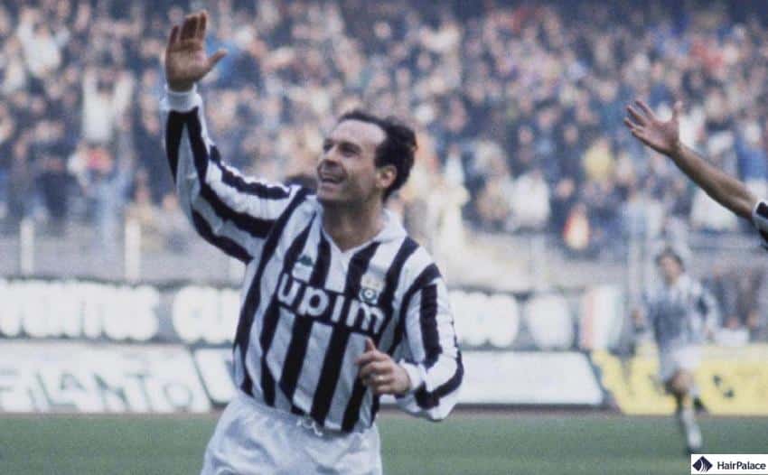 Trapianto capelli Schillaci Giovane