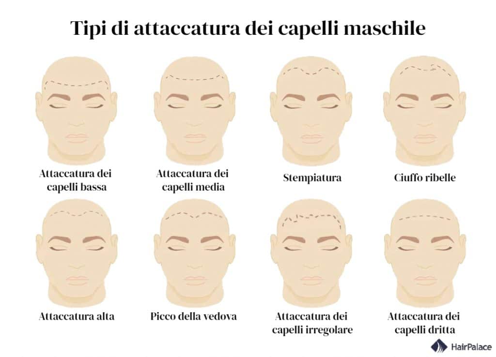 8 tipi più comuni di attaccatura dei capelli maschile