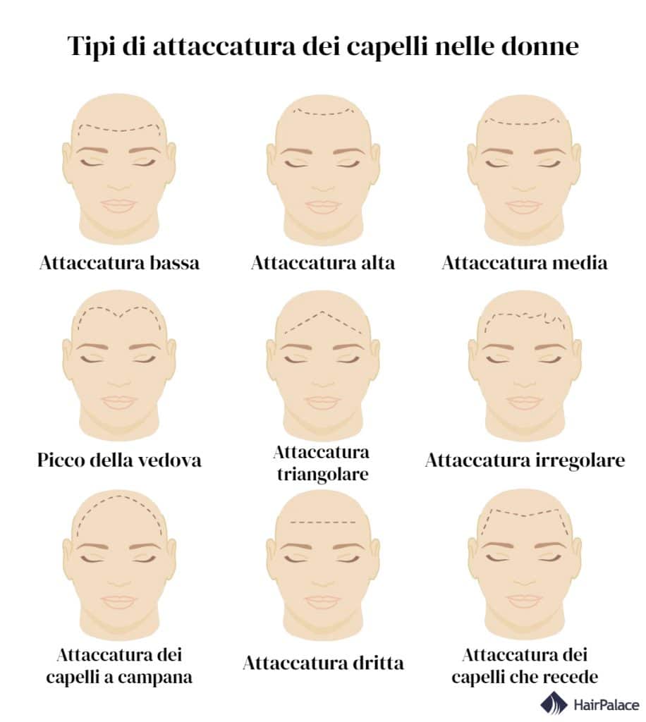 L'attaccatura dei capelli di una donna