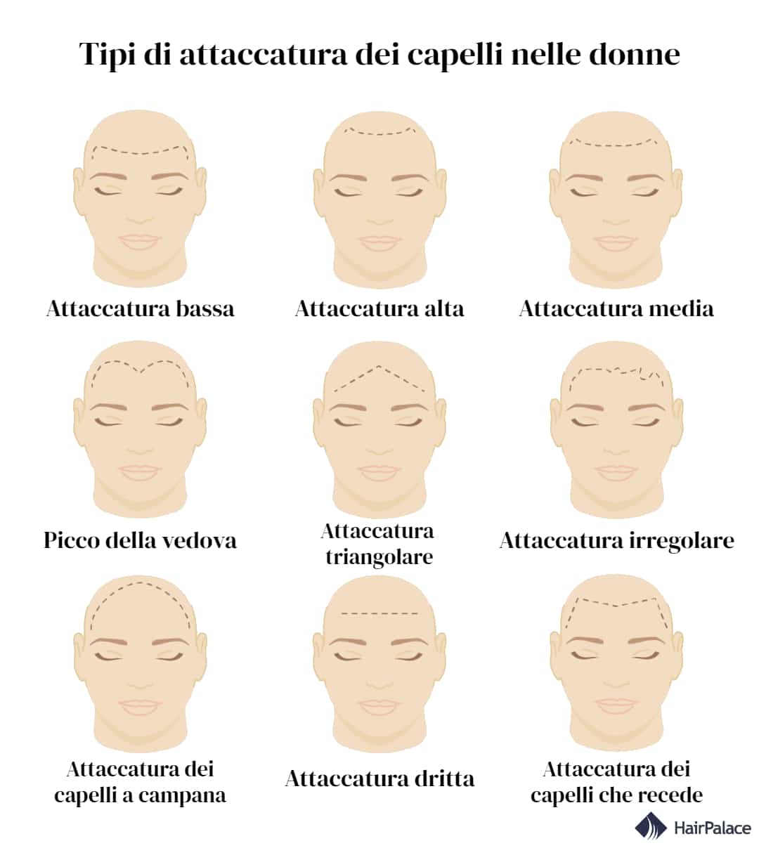 Tipi di Attaccatura dei Capelli e Come Cambiare la Sua