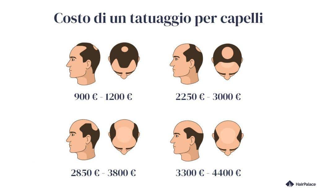 prezzo di un tatuaggio per capelli