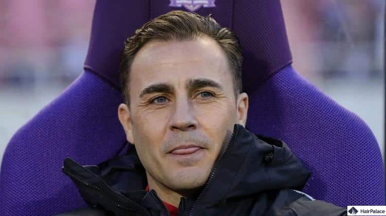 trapianto capelli cannavaro