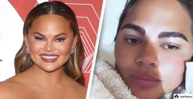 Chrissy Teigen prima e dopo il trapianto di sopracciglia