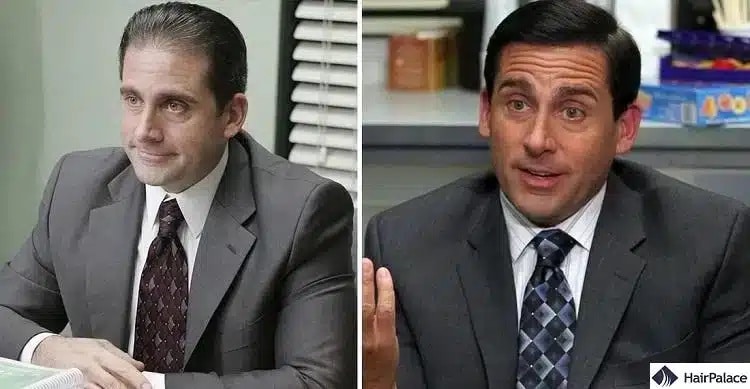 Trapianto di capelli Steve Carell prima e dopo