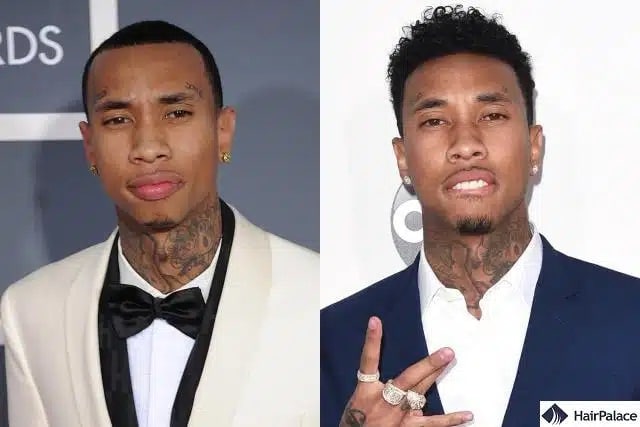 Trapianto di capelli Tyga prima e dopo