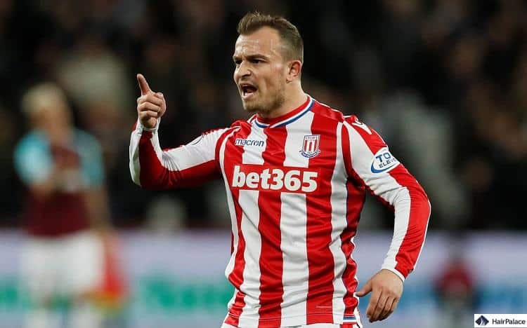 La caduta dei capelli di Xherdan Shaqiri è solo peggiorata col passare del tempo