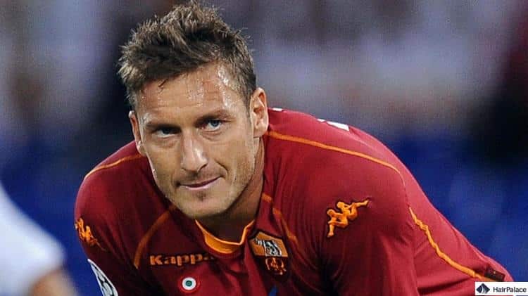 Il trapianto di capelli di Totti potrebbe essere avvenuto verso la fine del suo periodo alla Roma