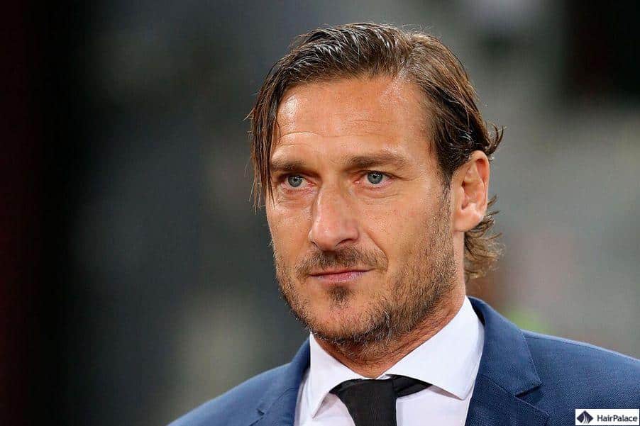 trapianto capelli totti