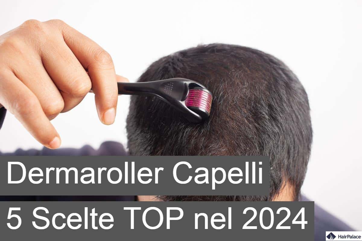 dermaroller capelli 5 scelte top nel 2024