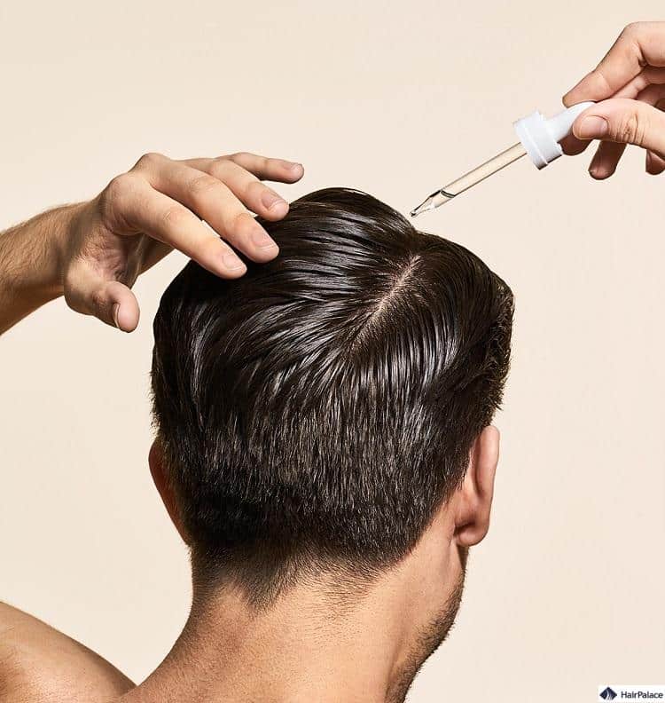 come applicare la finasteride topica