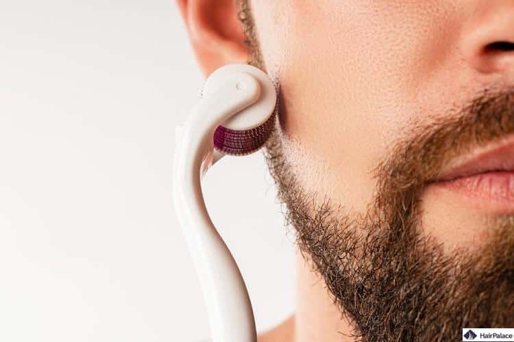 un derma roller kit per barba può stimolare la crescita della barba