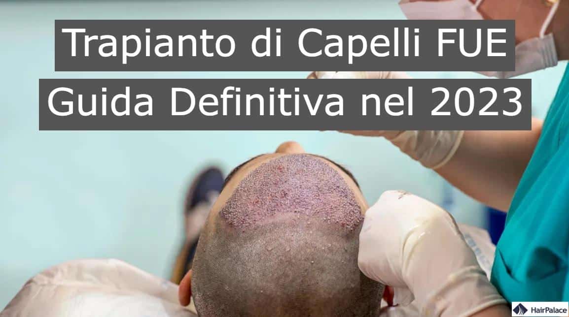 trapianto di capelli FUE guida definitiva nel 2023