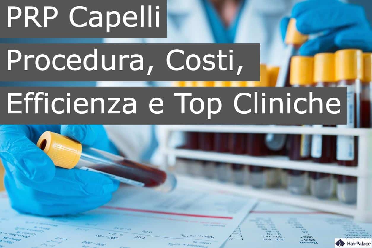 PRP capelli procedura costi efficienza e top cliniche