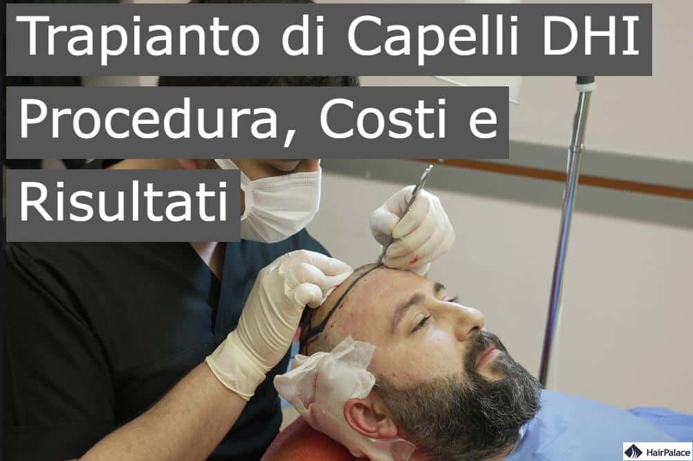 Trapianto di capelli DHI procedure costi e risultati