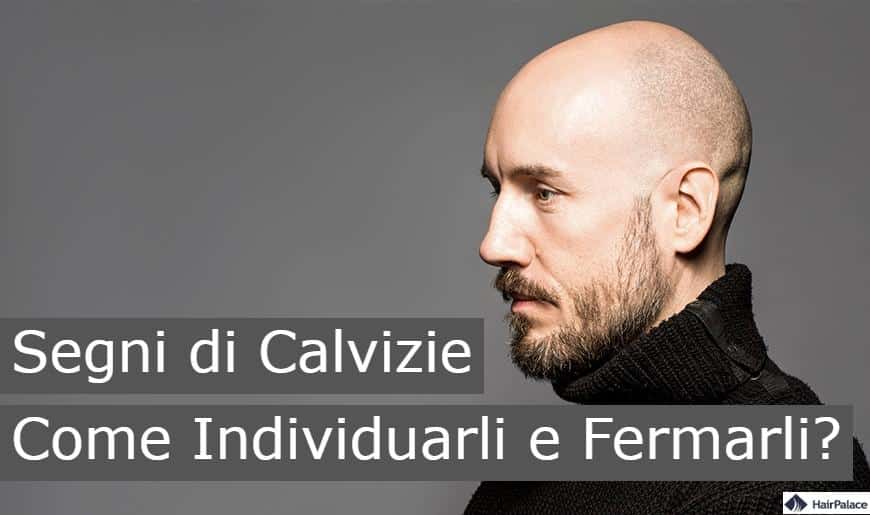 segni di calvizie come individuarli e fermarli