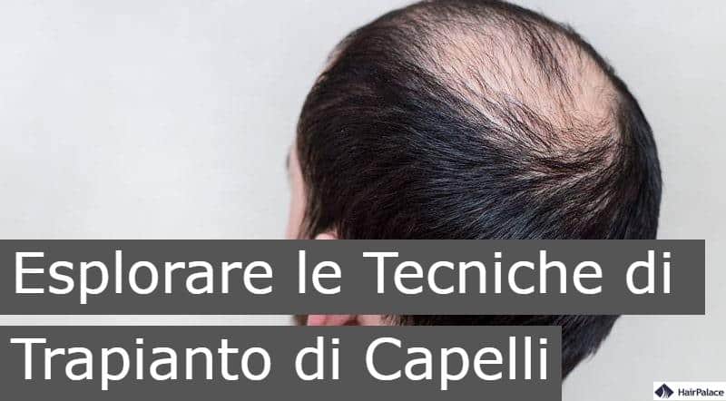 esplorare le technice di trapianto di capelli