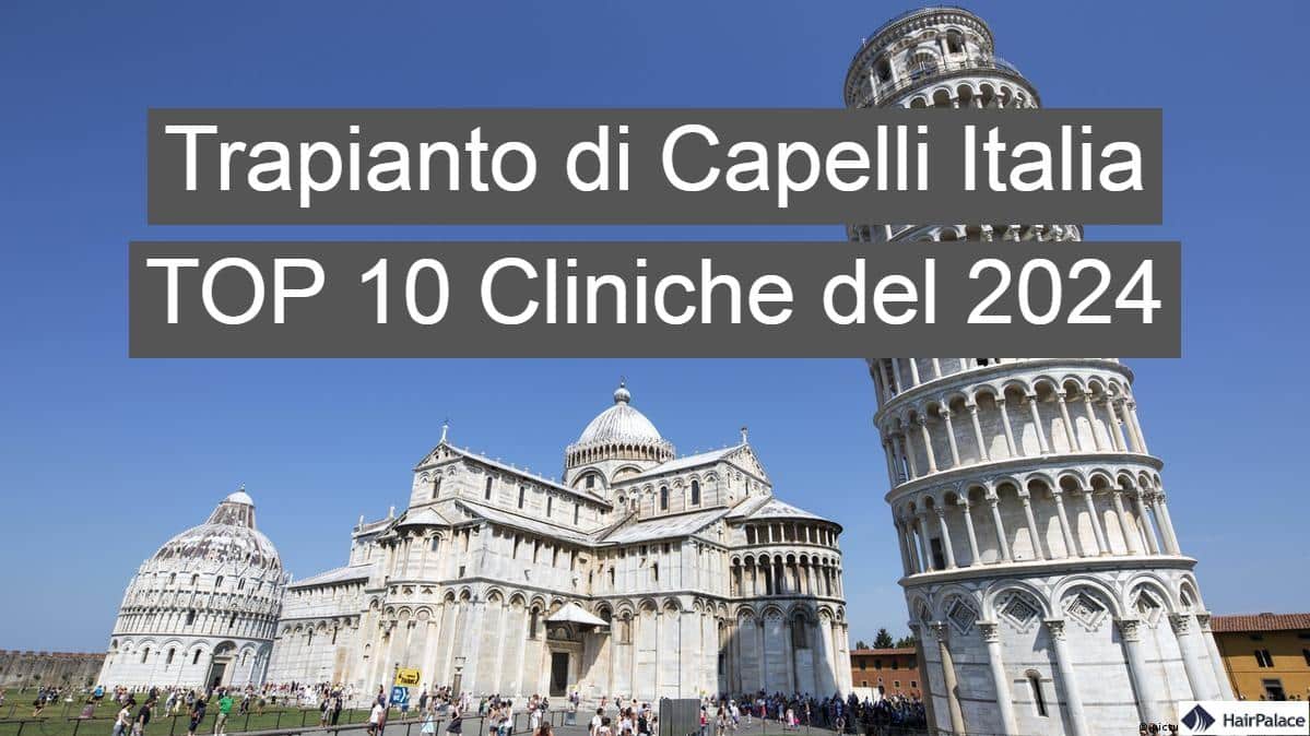 trapianto di capelli italia top 10 cliniche del 2024