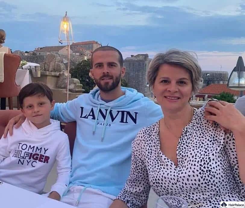 pjanic prima del trapianto di capelli