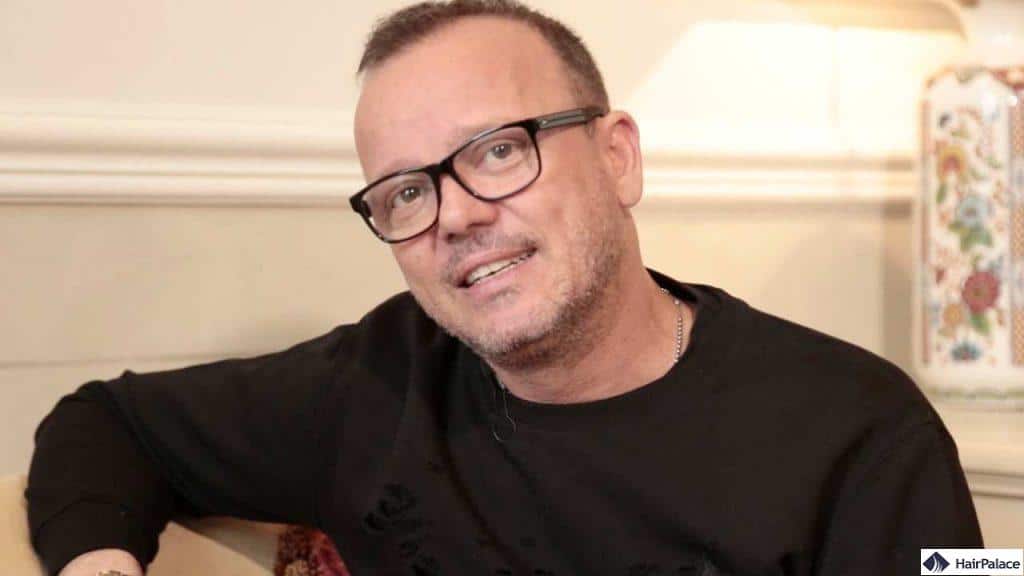 gigi d'alessio capelli trapianto