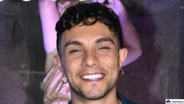 marco carta trapianto capelli